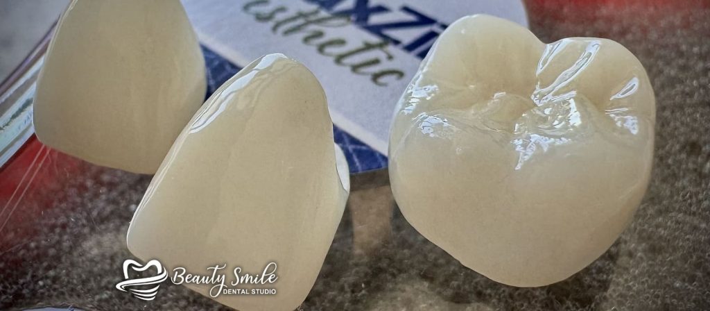 Top-quality zirconia crowns at Beauty Smile Dental Studio in Tijuana