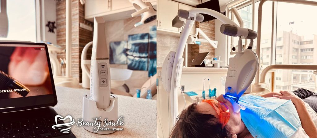 Beauty Smile Dental Studio in Tijuana featuring a high-tech scanner and professional laser teeth whitening treatment for top-quality dental care.