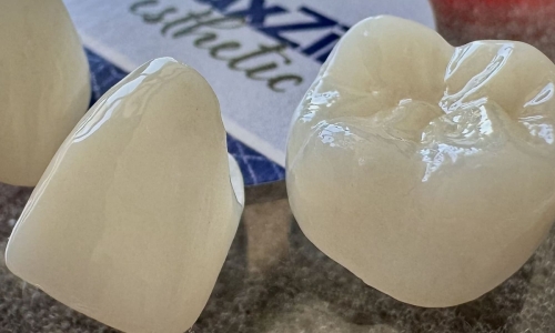 Cosmetic Dentistry