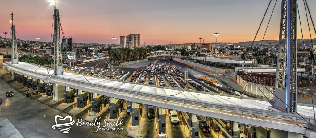 Pacientes que regresan a los EE.UU. desde Tijuana después de recibir servicios dentales en Beauty Smile Dental Studio, una clínica dental líder en turismo dental.