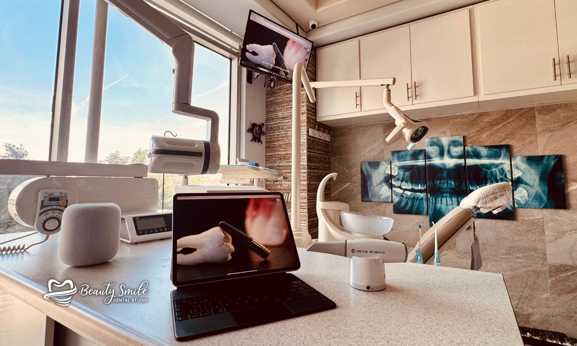 Instalaciones modernas en Beauty Smile Dental Studio en Tijuana, que muestran tecnología dental avanzada y un ambiente acogedor para una atención dental de la más alta calidad.