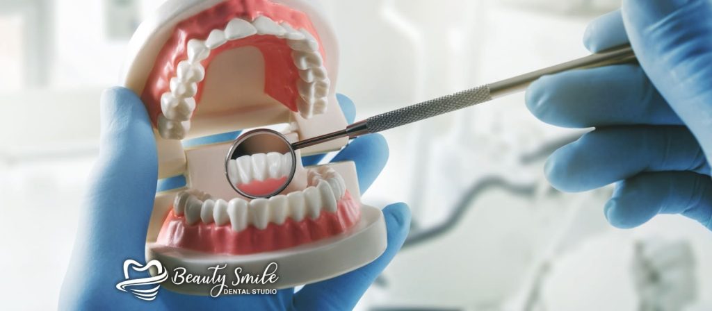 Un modelo dental en Beauty Smile Dental Studio en Tijuana, simbolizando una experiencia fluida en el cuidado dental.